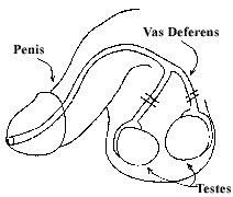 figure 1. diagram of vasectomy