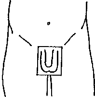 figure 2: area to be shaved